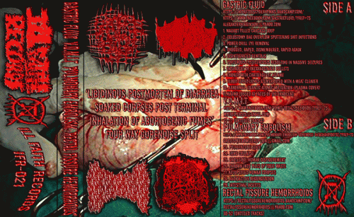 Gastric Fluid : Libidinous Postmortem of Diarrhea Soaked Corpses Post Terminal Inhalation of Abortogenic Fumes